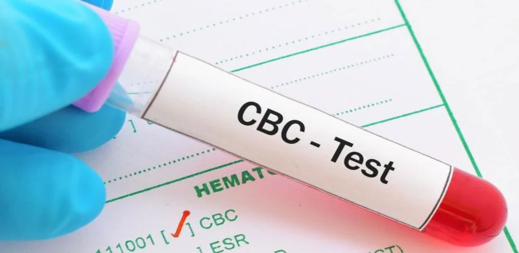 Complete Blood Count (CBC) – Everything You Should Know About It